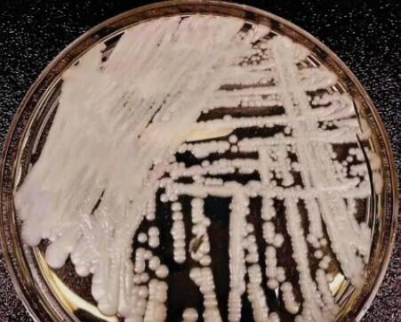 超级真菌在美爆发是怎么回事 超级真菌感染有