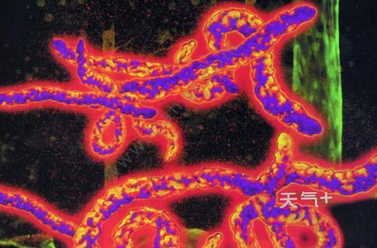 全球首个埃博拉病毒治疗方法是怎么回事埃博拉病毒治疗方法靠谱吗