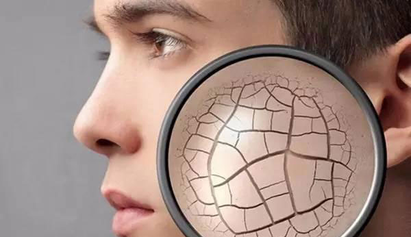 什么是干燥综合症 干燥综合症能治愈吗