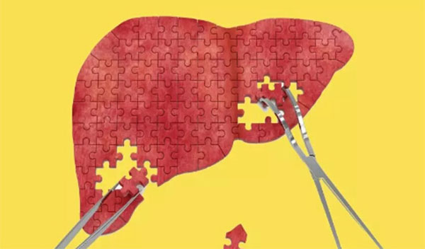 脂肪肝传染吗 脂肪肝会遗传给下一代吗