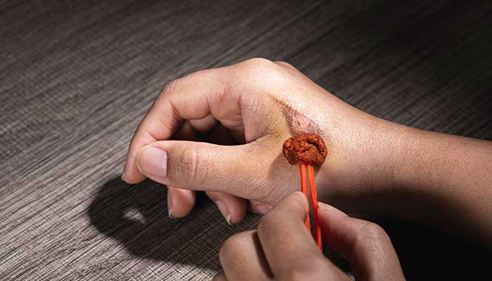 碘伏的作用与功效 碘伏的作用与功效有哪些