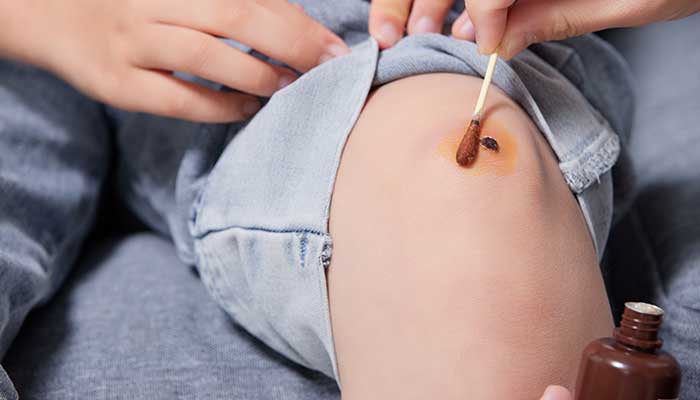 碘伏的作用与功效 碘伏的作用与功效有哪些