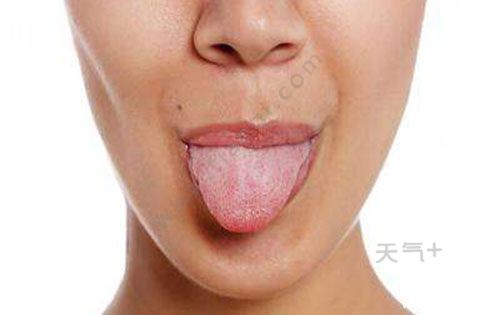 糖尿病的征兆8:萎型舌炎