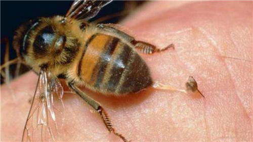 蜂咬了肿胀怎么处理？
