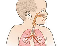 小儿支气管肺炎怎么办 支气管肺炎的饮食