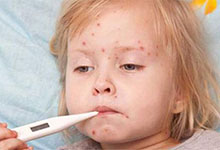感染水痘几天能好 水痘的症状和治疗