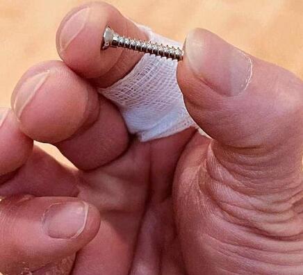 陶喆取出放在手指里15年的螺丝是怎么回事 陶喆取出放在手指里15年的螺丝具体情况