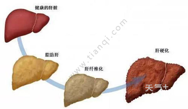 據調查發現,脂肪肝發病率現在在我國是處於一個逐年上升的階段,也就