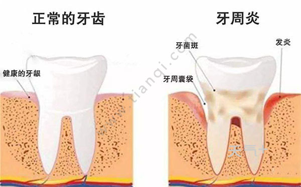 牙齿松动怎么办 牙齿松动是什么原因
