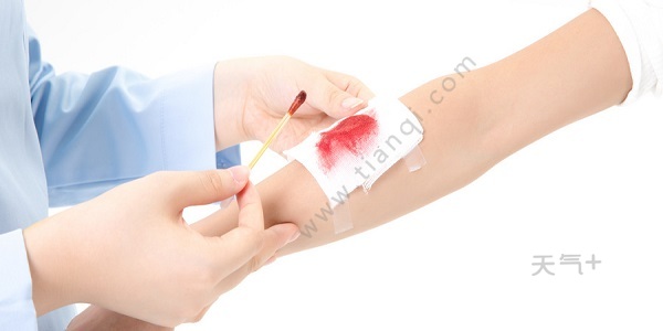 怎么区别肠道出血和痔疮_肠道出血和痔疮出血_怎么区分痔疮出血和肠道出血