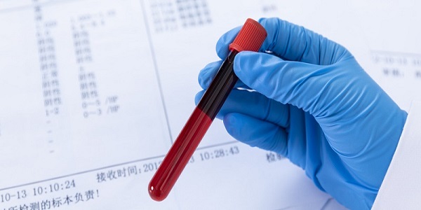 血常规能检查出什么 血常规主要检查什么病