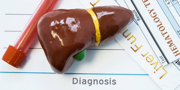 肝功能检查哪些项目 肝功能检查出什么
