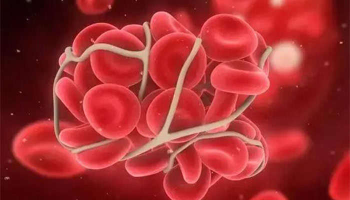 血浆和血清的区别 血浆和血清有什么区别