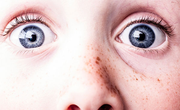 眼睛痒是怎么回事 哪些因素会引起眼睛痒