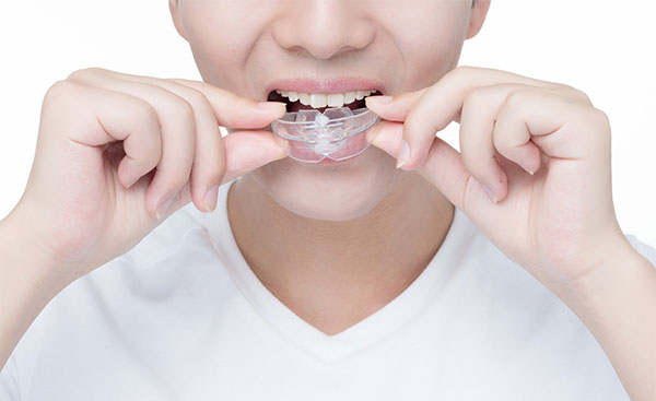 矫正牙齿的最佳年龄 哪些原因造成牙齿排列不齐